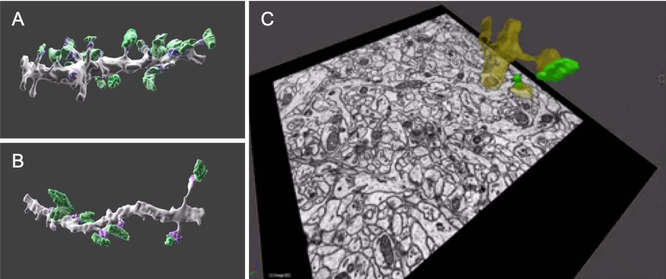 3D-View: Serial block-face scanning electron microscopy of the hippocampus which contains many neurons