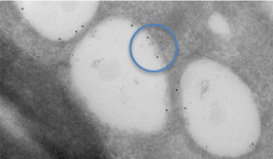 Dual labelling of lipid droplets in a cell infected with Hepatitis C virus