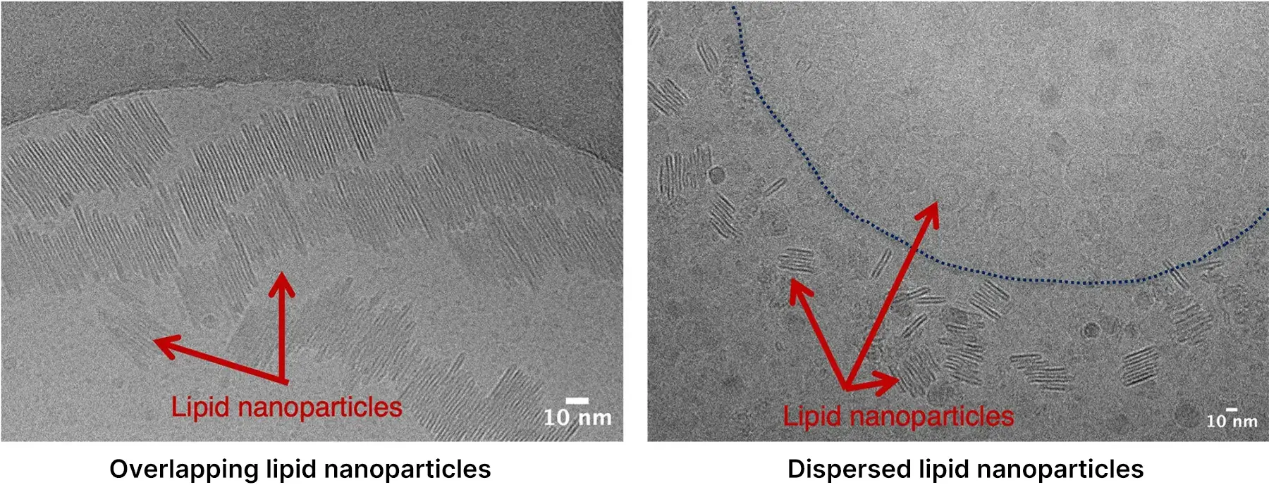 Left: Overlapping lipid nanoparticles, Right: Dispersed lipid nanoparticles