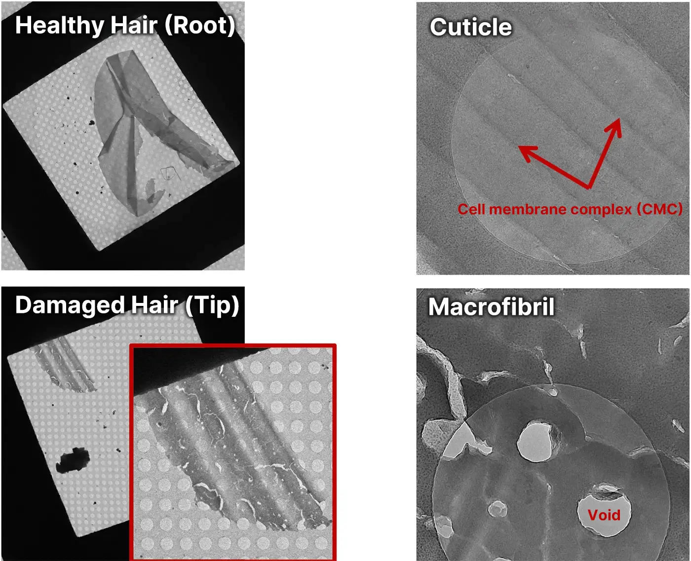 Healthy Hair (Root) and Damaged Hair (Tip). Cuticle and Macrofibril.