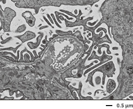 JEOL lancia il nuovo microscopio elettronico a scansione ed emissione di  campo Schottky JSM-IT800 - Tecnomedicina