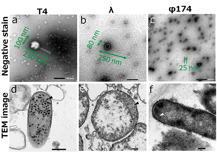 TEM images of phages.