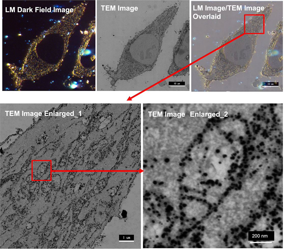 Observation of TOM20 localization in HeLa cell