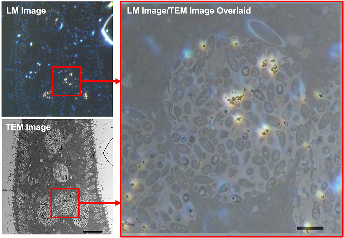 ตัวอย่าง: ภาพ Paramecium TEM / ภาพ LEM