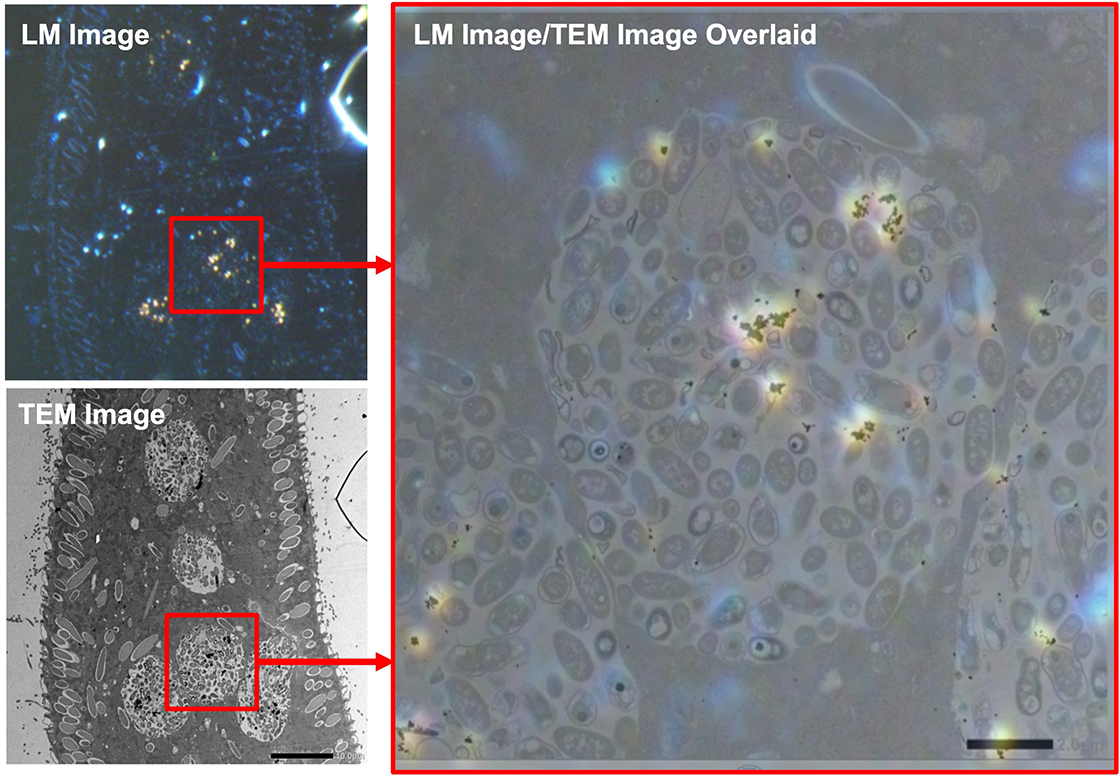 Contoh: imej Paramecium TEM / imej LEM